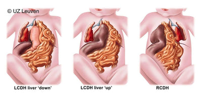 What is CDH