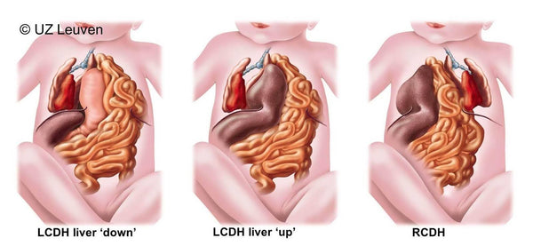 What is CDH